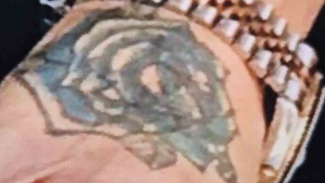 Foto - Yaptırmadan önce bir kez daha düşünün: İşte dövme hastalığının kötü sonu