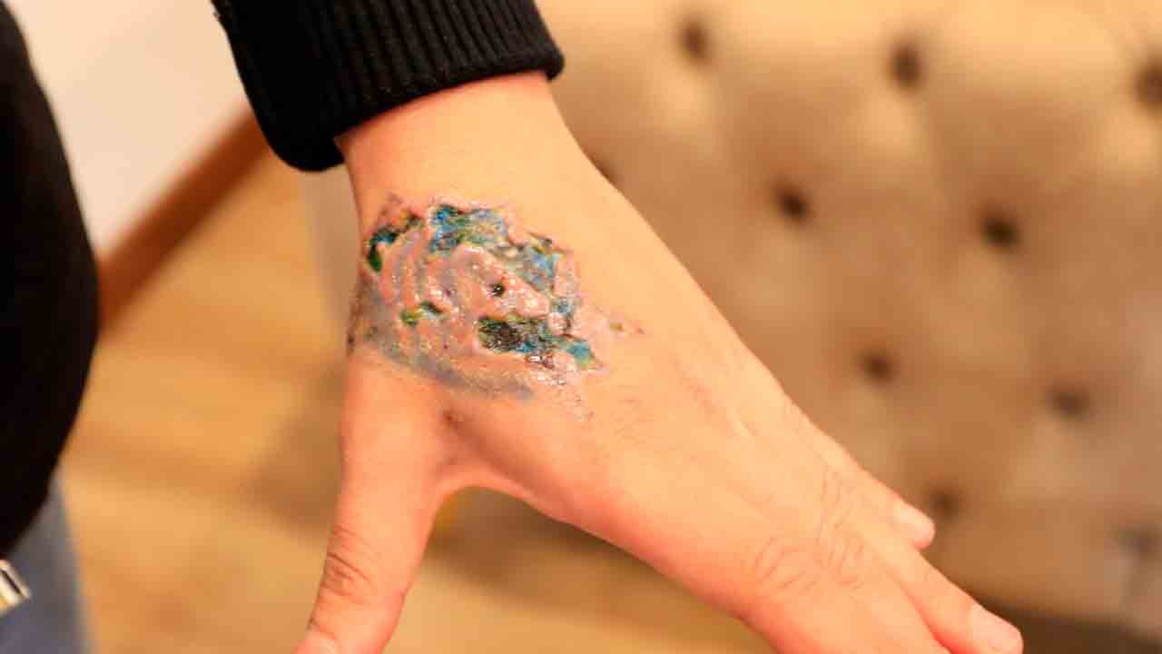 Foto - Yaptırmadan önce bir kez daha düşünün: İşte dövme hastalığının kötü sonu