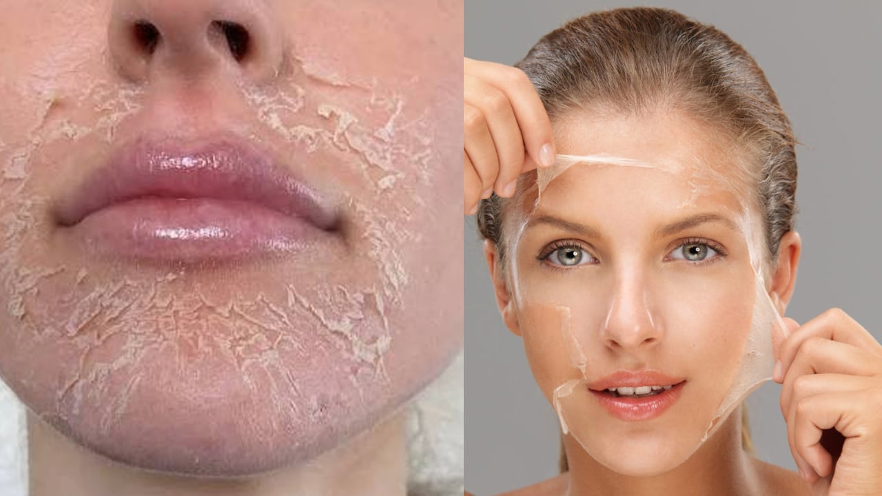 Foto - Yarardan çok zarar mı? Peeling ne işe yarar, nasıl uygulanır? Çok ama çok şaşıracaksınız
