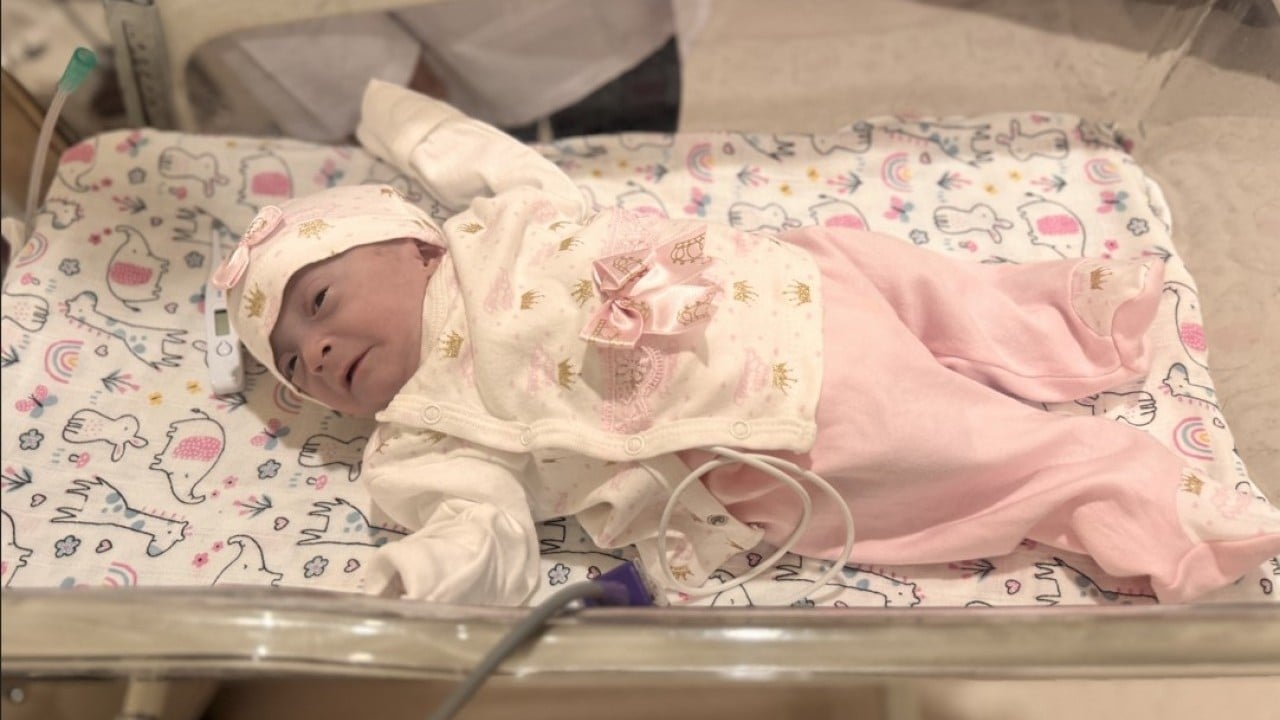 Foto - "Yaşamaz" denilmişti! 465 gramlık Hüma bebek anne kucağına kavuştu