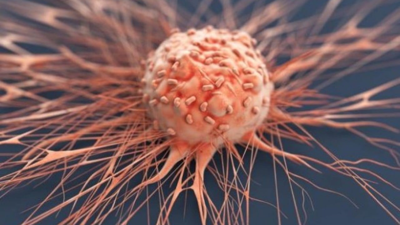 Foto - Yaşlı genç dinlemiyor! Bağırsak kanseri riski arttı