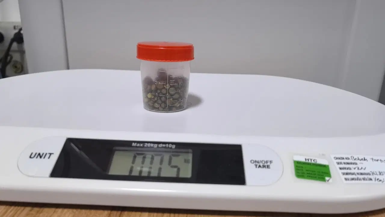 Foto - Yaşlı kadını apar topar ameliyata aldılar! Doktorlar bile gözlerine inanamadı: Tam 213 tane