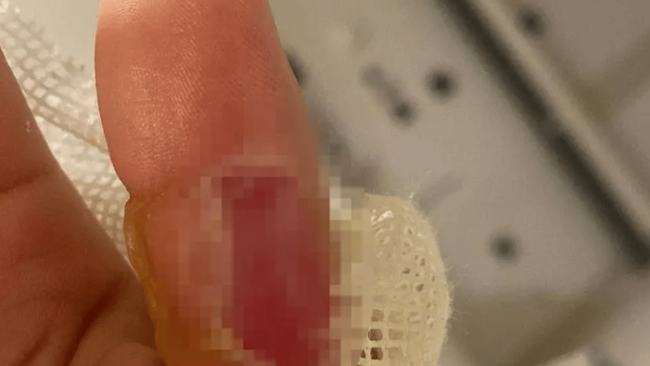 Foto - Yanınıza almadan kontrol edin: Sonuçları ölümcül olabilir!