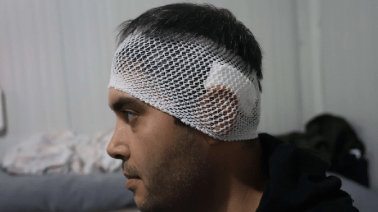 Foto - Yatağında uzanırken ölümden döndü! Bakın başına ne düştü