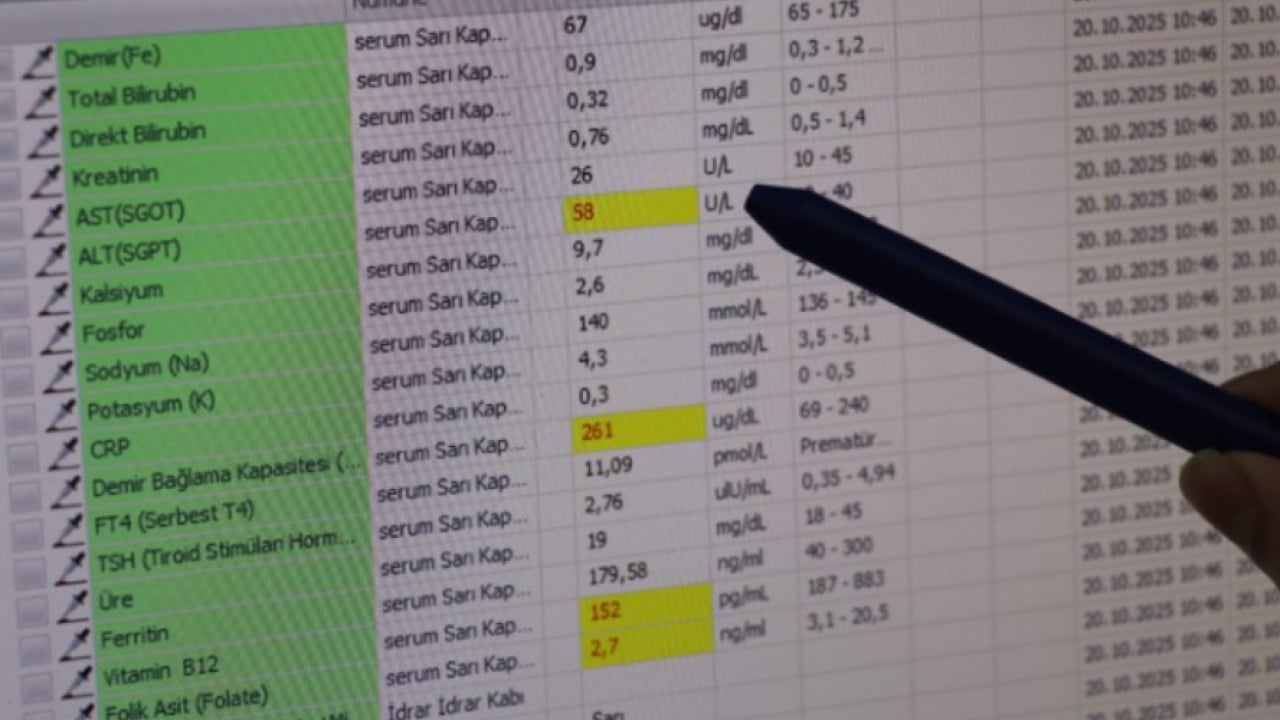 Foto - Bu şekilde beslenirseniz kaybedersiniz: Karaciğerin en büyük düşmanı!