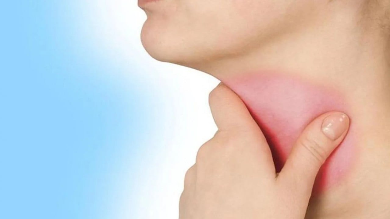 Foto - Yemek borusu kanserine dikkat!