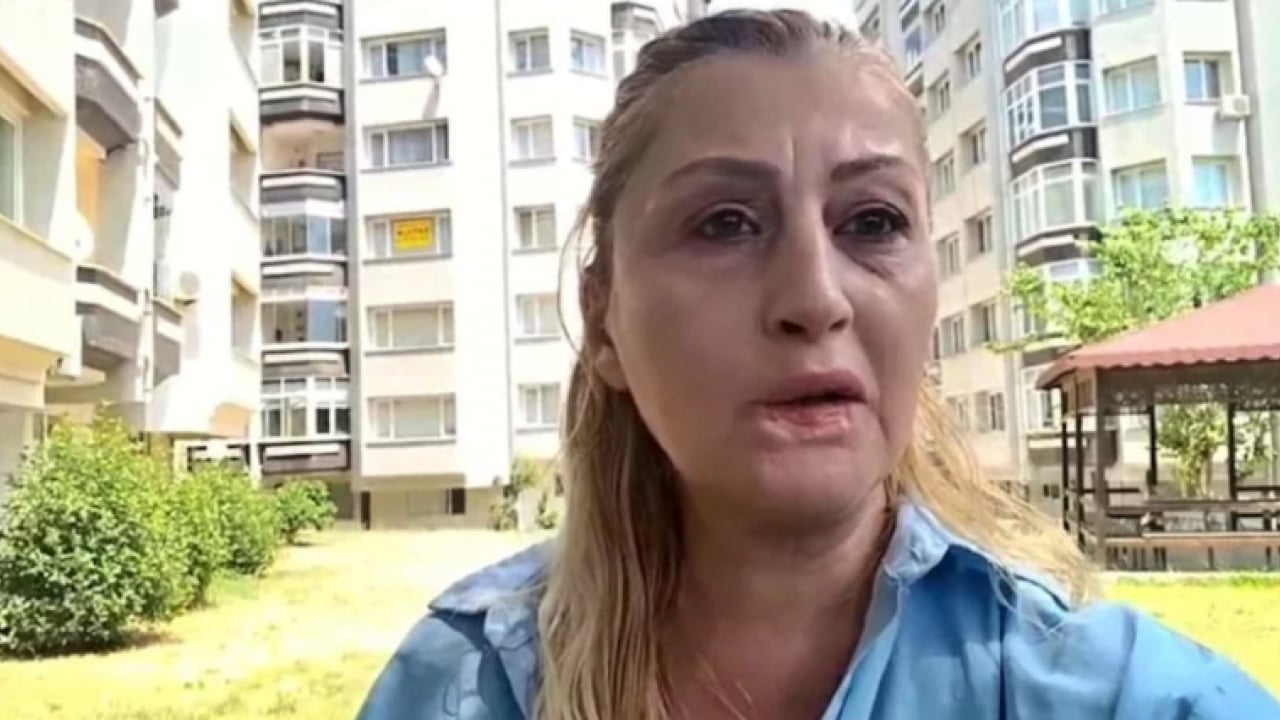 Yemek bile artık problem! Dolgu dudak hayat kararttı