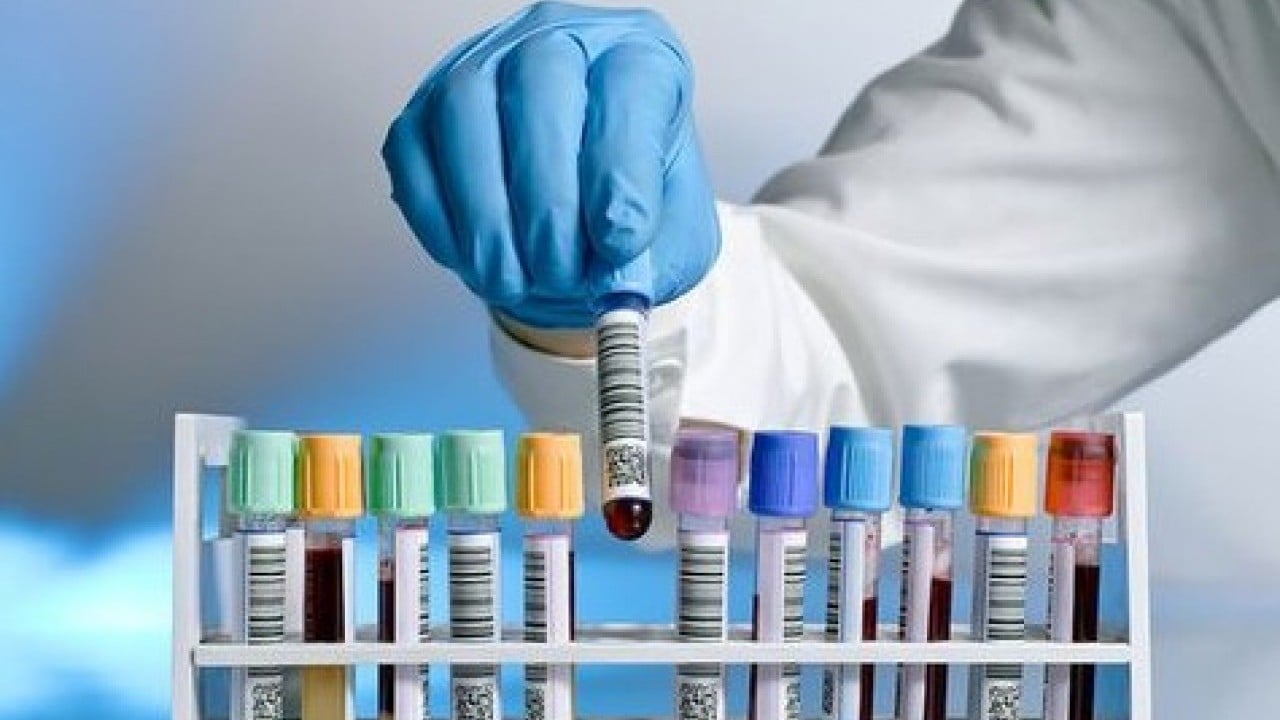 Foto - Yeni dönem başlıyor: Artık sıra beklemek yok!