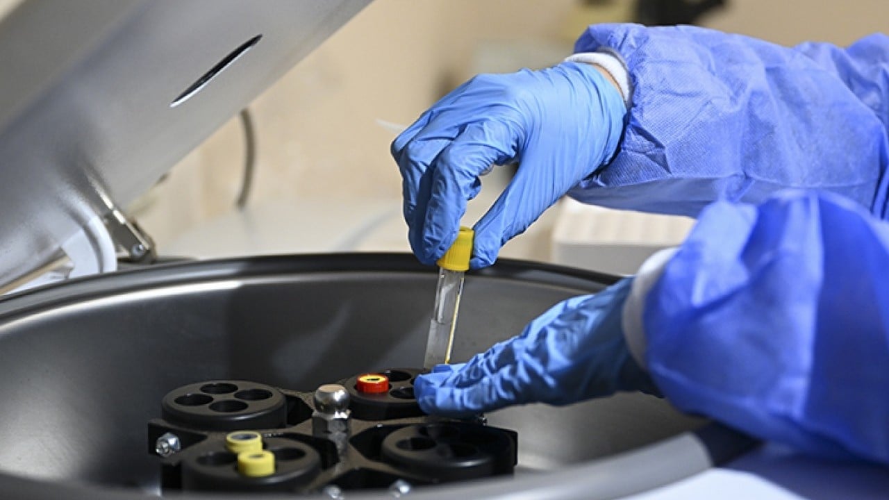 Foto - Yerli gen tedavisi araştırma ürünü için start veridi