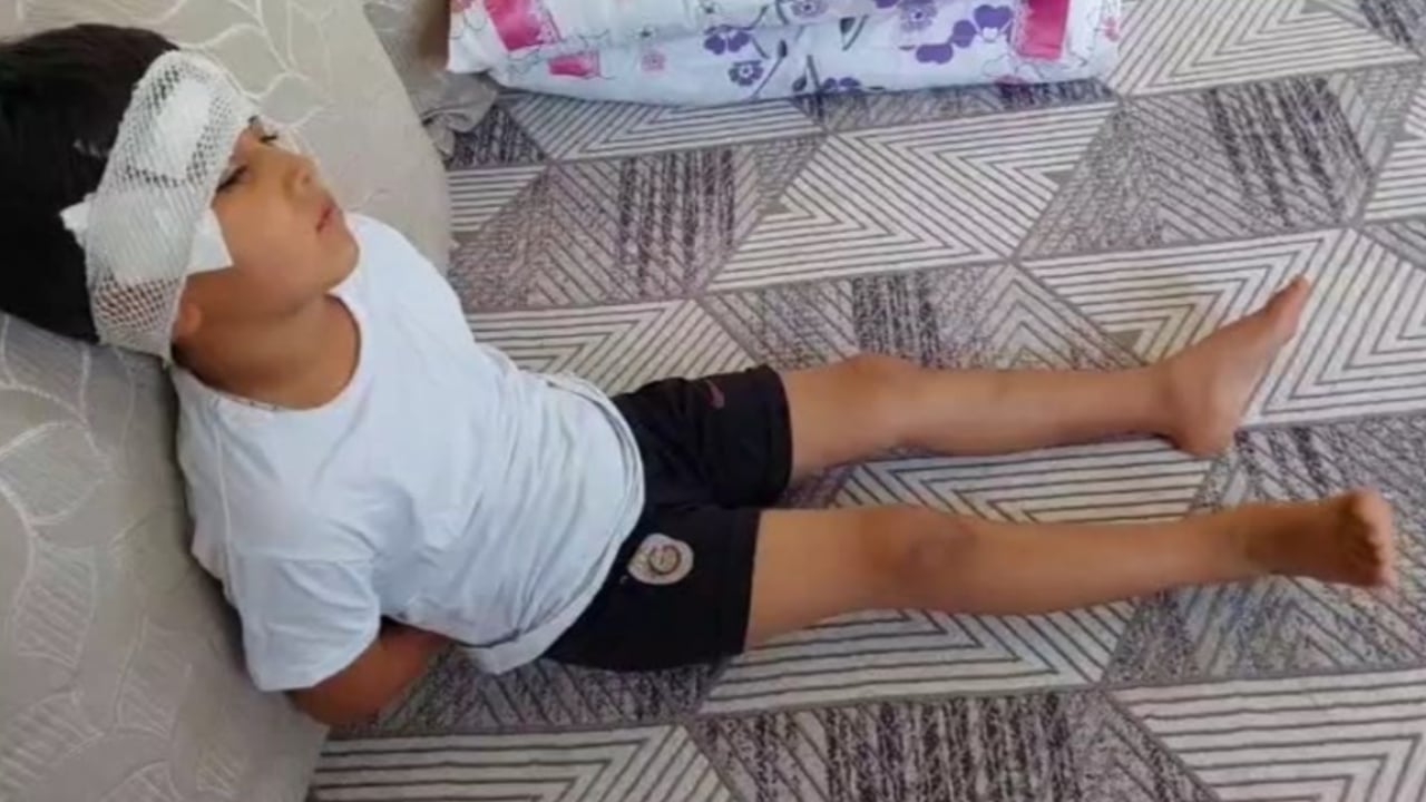 Foto - Yine başıboş köpek kabusu! Babası yetişmese hayatı kararmıştı!