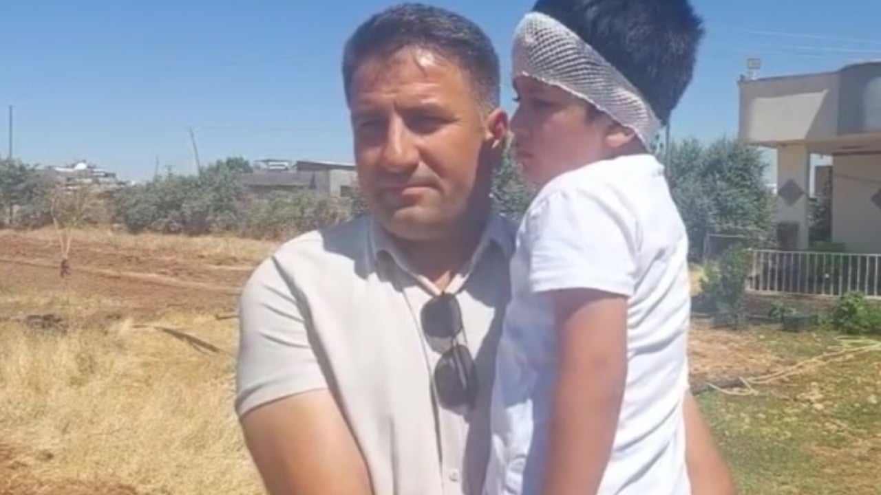Yine başıboş köpek kabusu! Babası yetişmese hayatı kararmıştı!