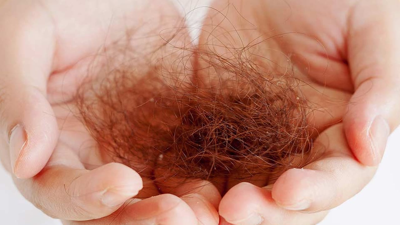 Foto - Yoğun saç dökülmesine karşı etkili önlemler böyle oluyor! Araştırma sonucu açıklandı: Yoğun stresin etkisi çıktı