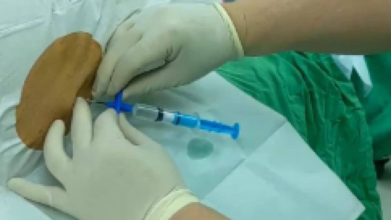 Foto - YTÜ’lü profesörlerden ‘akıllı şırınga’ devrimi: Ameliyatlarda hata payı sıfıra iniyor