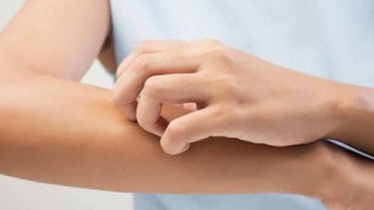 Foto - Yüzde, ayakta, elde egzama neden olur? Testi etkileyecek: Bunları biliyor musunuz? Tüm detaylara dikkat