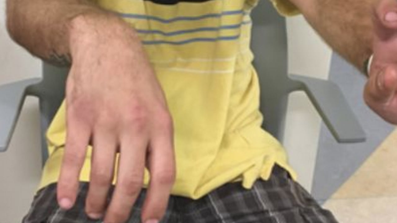 Foto - Yüzde kayma ve konuşma bozukluğu varsa göz ardı etmeyin diyen Doç. Dr. Melih Üçer sinir hasarı işareti olabilir diyor