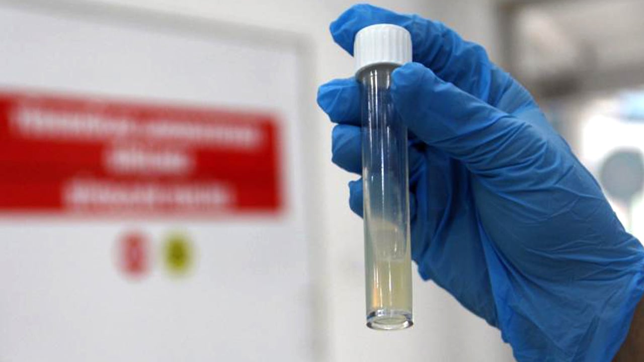 Yüzyıllık düşman bitmedi: Tüberküloz hâlâ en ölümcül bulaşıcı hastalık