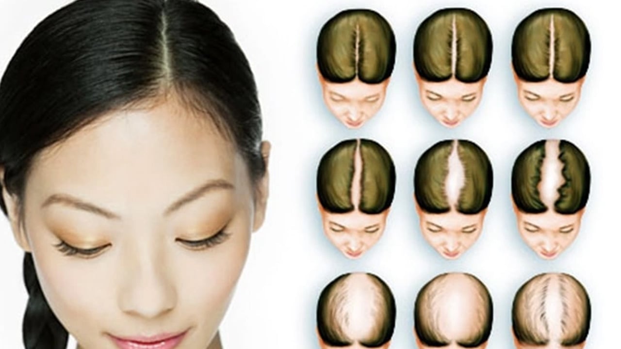 Zehir saçıyor: 'Vitamin kullanıyorum ama saçım hala dökülüyor' diyenler dikkat! Kadın erkek herkes şikayetçi!