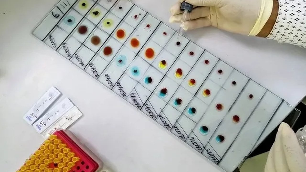 Foto - Zeka küpü olanlar bu grupta: İşte IQ’su en yüksek kan grubu