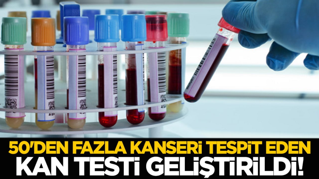 50'den Fazla Kanseri Tespit Eden Kan Testi Geliştirildi!