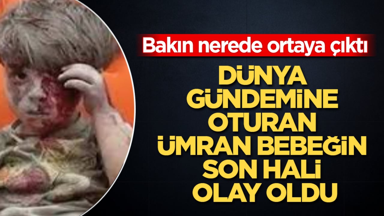 Dünya gündemine oturan Ümran bebeğin son hali olay oldu! Bakın nerede ortaya çıktı