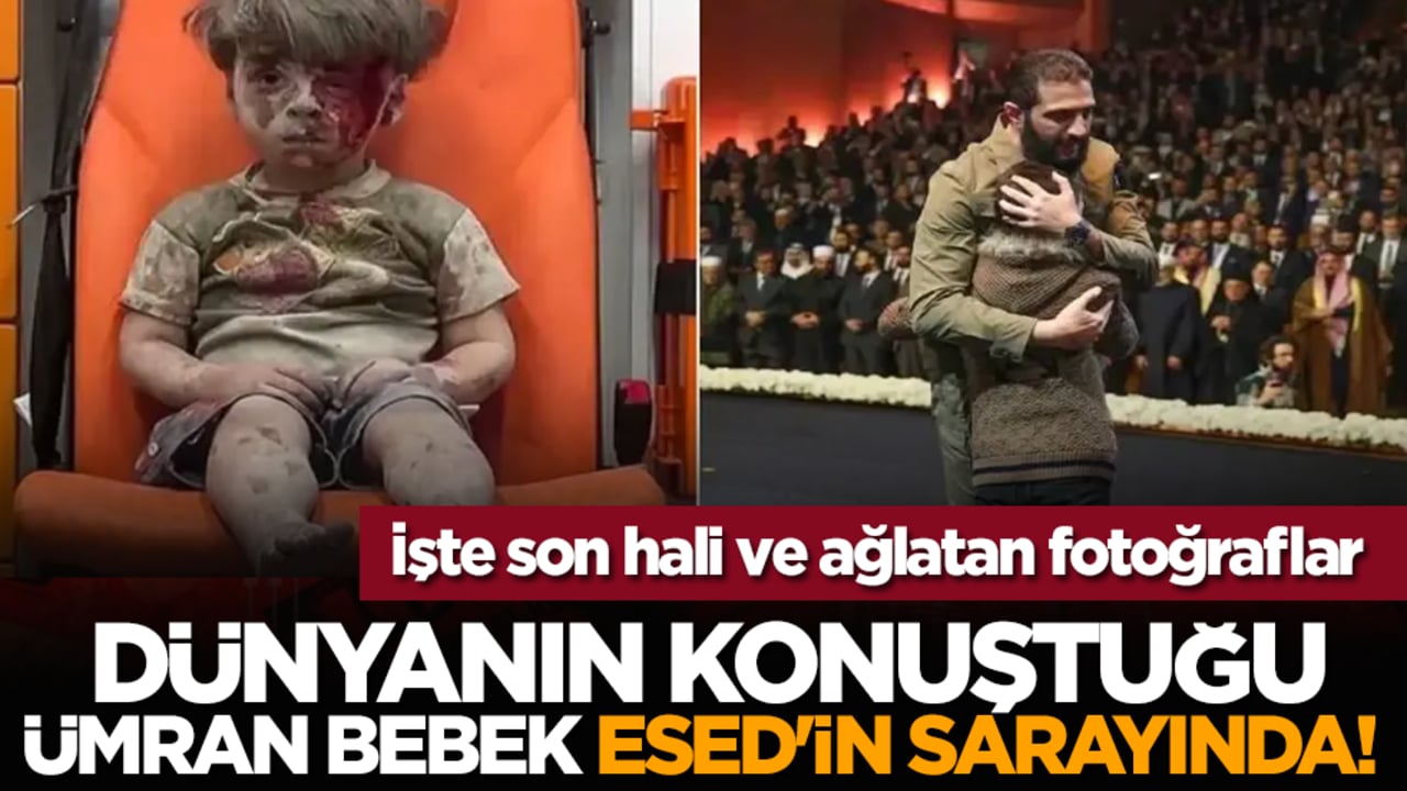 Dünyanın konuştuğu Ümran Bebek Esed'in sarayında! İşte son hali ve ağlatan fotoğraflar...