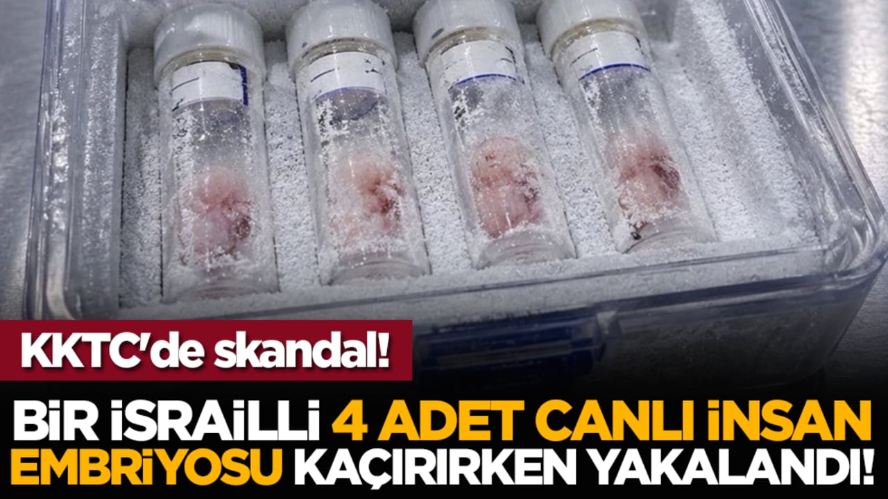 KKTC'de skandal! Bir İsrailli 4 adet canlı insan embriyosu kaçırırken yakalandı!