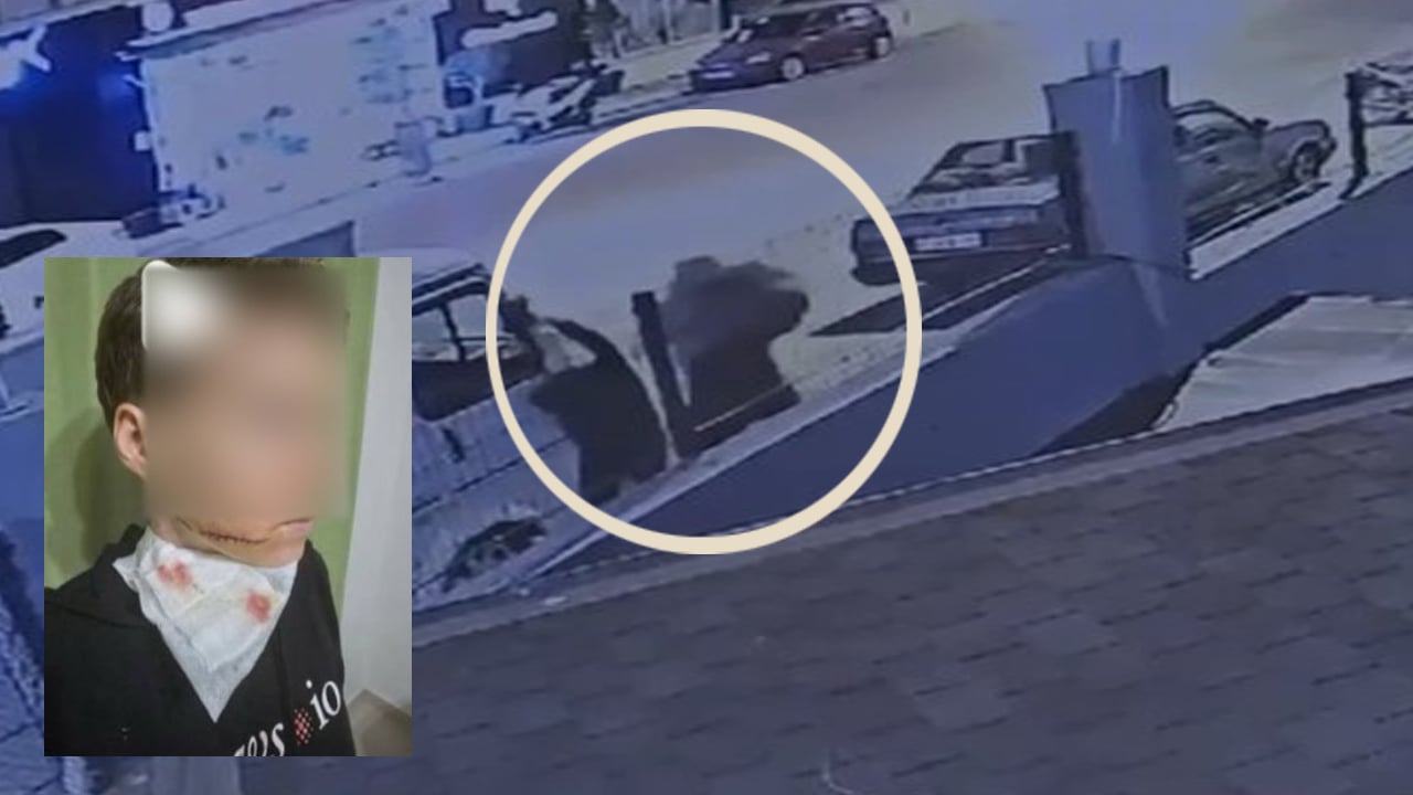 Manyak tutuklandı! Yolda yürüyen hiç tanımadığı kadını yumruklayıp makasla yaralamıştı