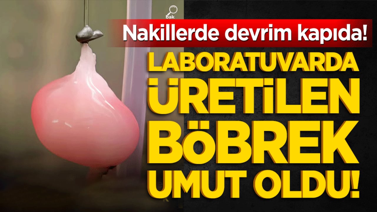 Nakillerde devrim kapıda! Laboratuvarda üretilen böbrek umut oldu!