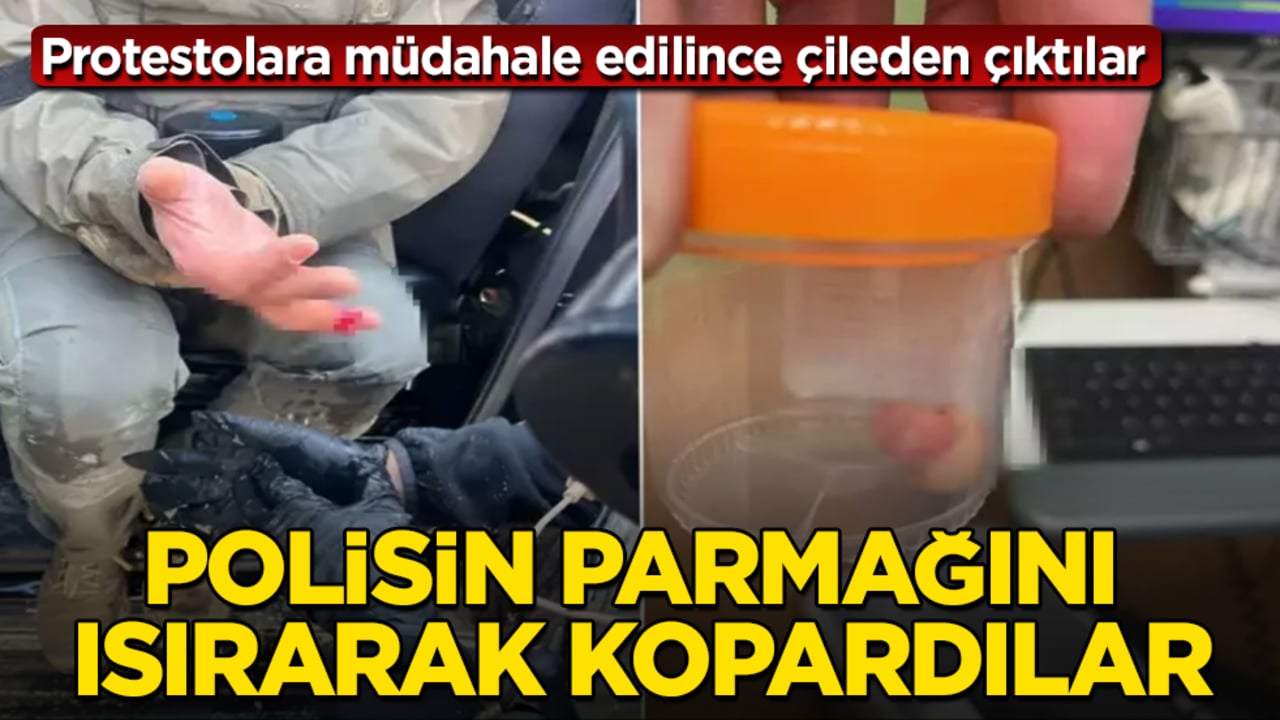 Protestolara müdahale edilince çileden çıktılar! Polisin parmağını ısırarak kopardılar