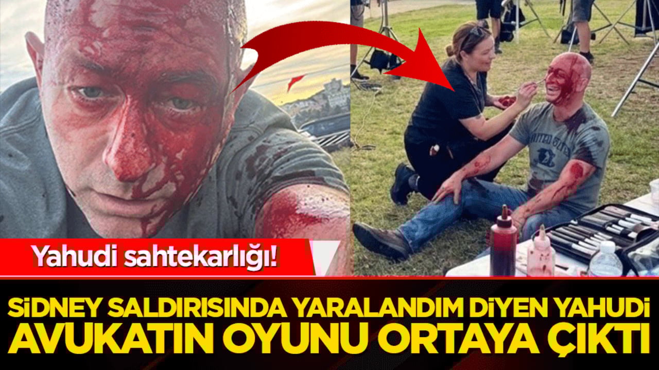 Sahte yarayla mağduriyet oyunu! Gerçek sonradan ortaya çıktı