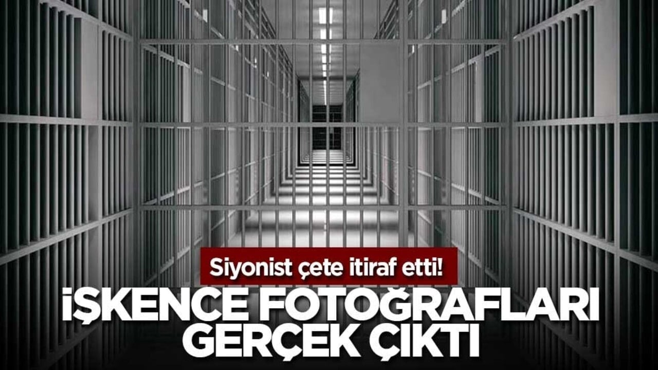 Siyonist sürüsü itiraf etti! İşkence fotoğrafları gerçek çıktı
