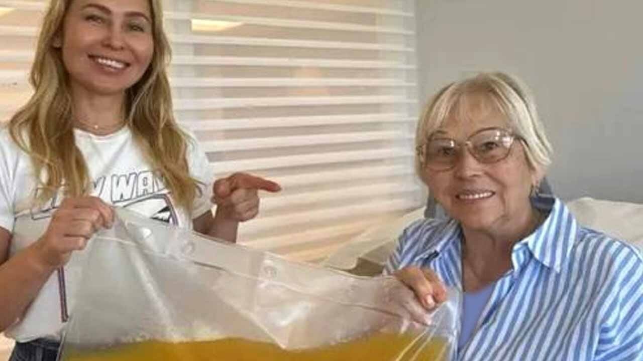 Zenginlerin uzun yaşam için tercihi: Plazmaferezle sağlığını koruyor, 160 kilo verdi