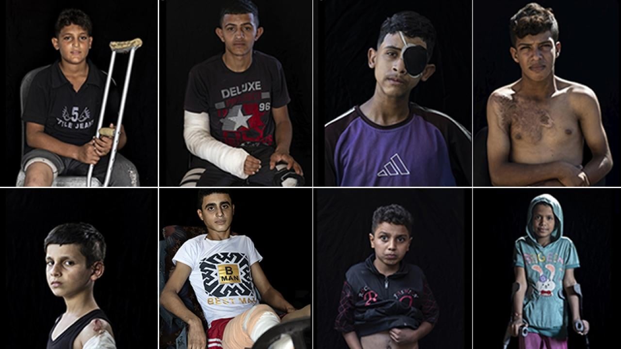 2 Yıllık Soykırımın Bilançosu! Gazze artık 'ampute çocuklar şehri' oldu