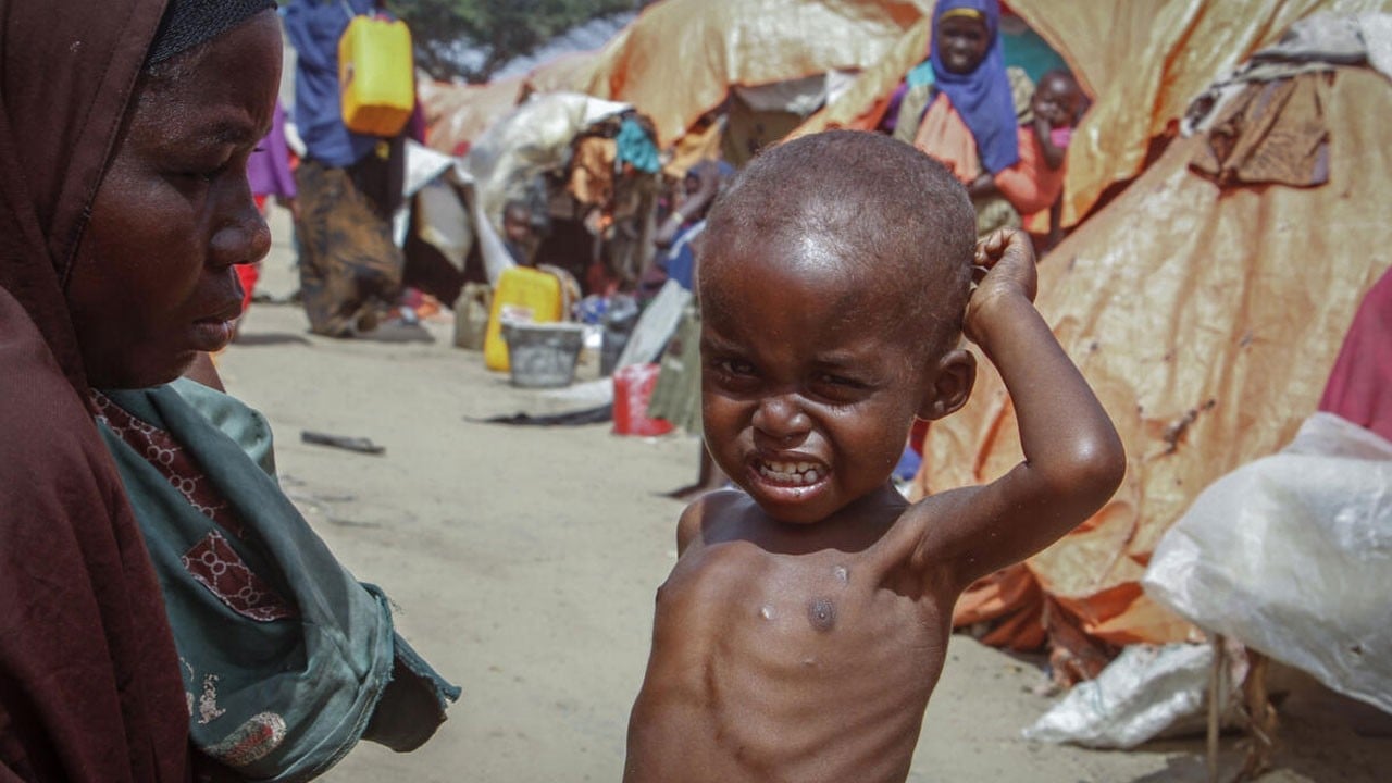 6,5 milyon kişi açlıkla ölüm arasında! Açlık kıskacında bir ülke