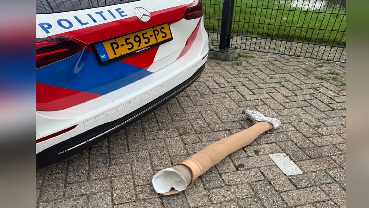 Acemi hırsız kaçarken bacağını düşürdü