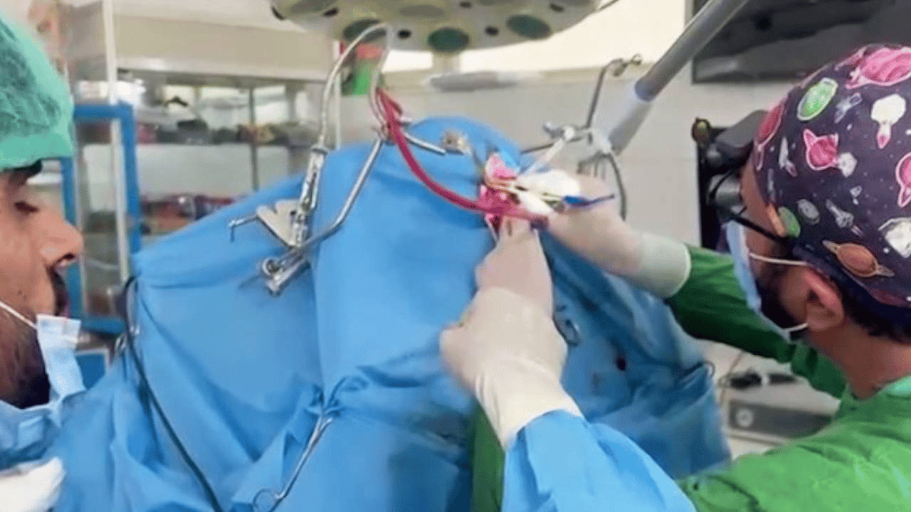 Afganistan İslam Emirliği'nde ilk beyin tümörü ameliyatı başarıyla yapıldı