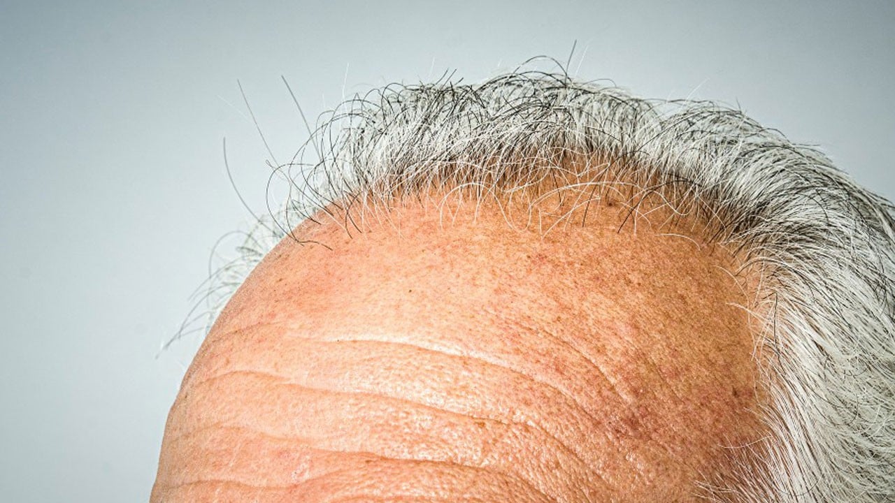 Aman çok dikkat edin! İşte erken yaşlanma ve saç dökülmesinin gizli nedeni