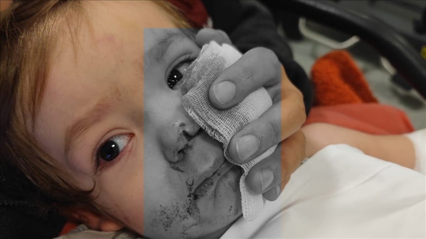 Ankara'da 2 çocuğu yaralayan pitbull cinsi köpeğin sahibi hakkında iddianame düzenlendi