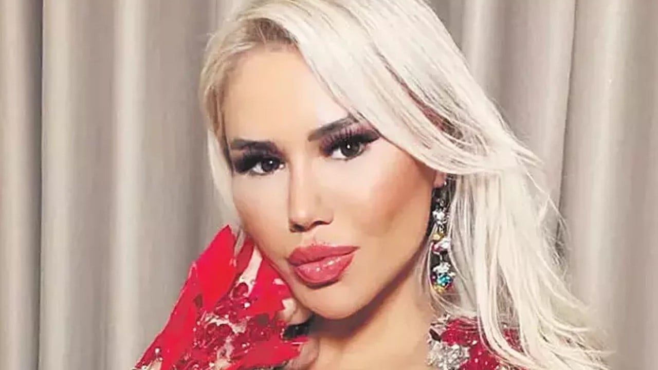 Asla yaptırmıyorum! Ünlü şarkıcı Ceylan'dan estetik itirafı: Fena madara oldu...