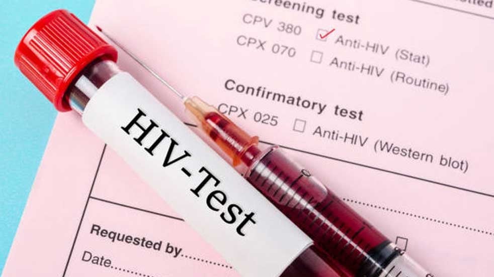"Bağışıklık sistemini hedef alıyor" HIV tehdidi devam ediyor