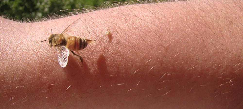 Bal arısı soktuktan sonra neden ölür ve iğnesi kalır?