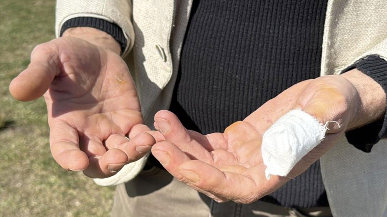 Başıboş pitbull dehşet saçtı