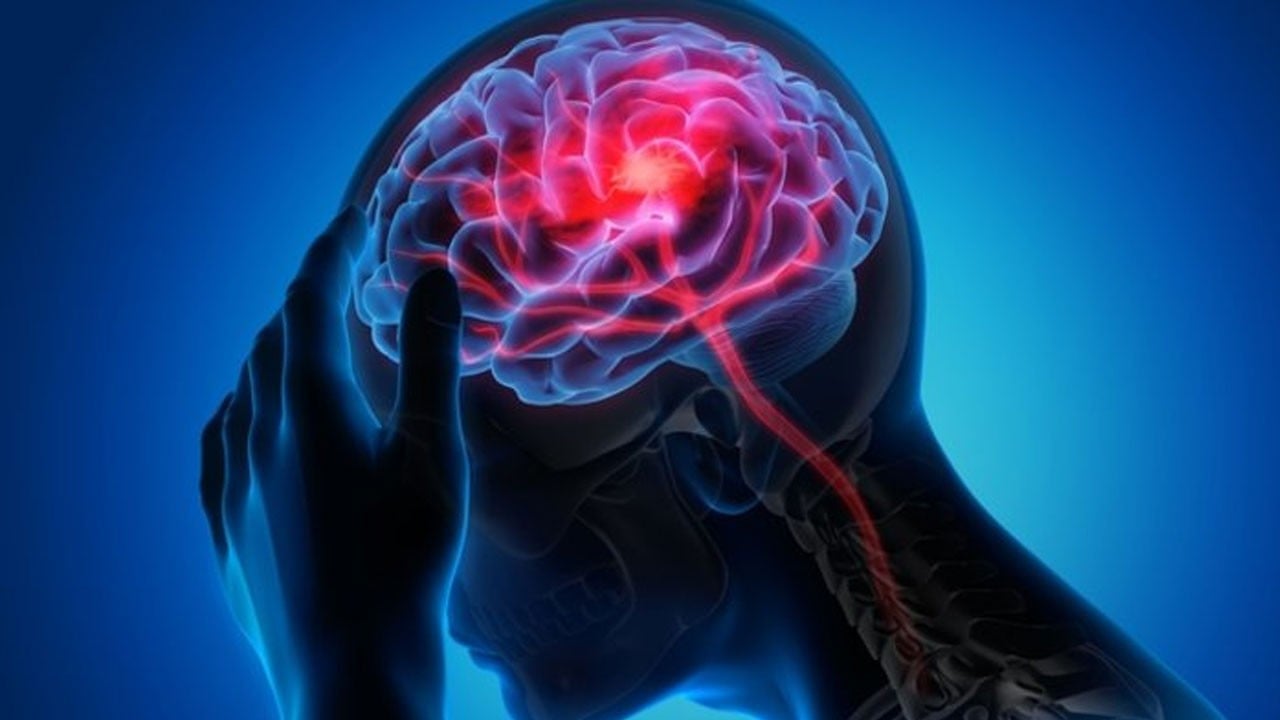 Beyin sisi bakın hangi hastalığın habercisi?