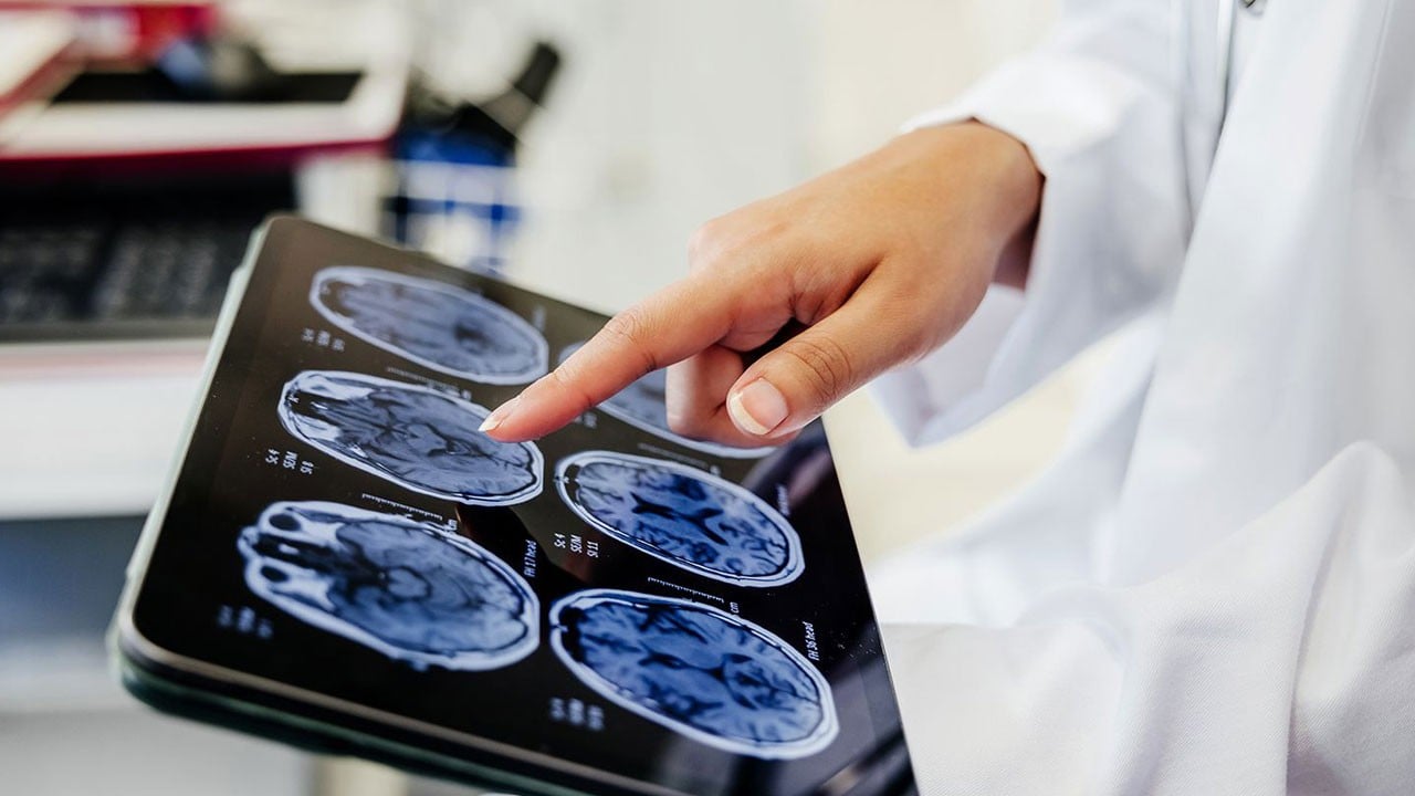 Beynin gelişimi tamamen yeniden tanımlandı! Bakın ergenlik kaç yaşına kadar sürüyormuş