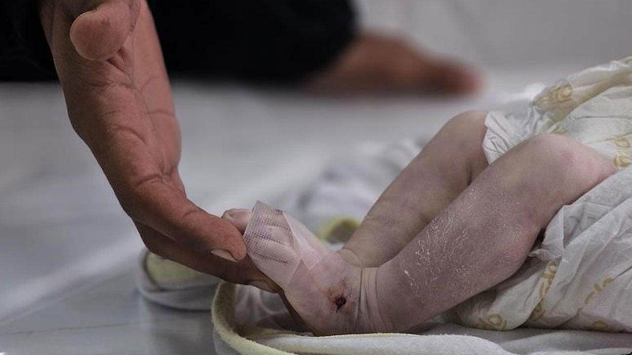 Bombadan kurtuldular, kıştan kurtulamadılar! Gazze’de 10 çocuk soğuktan öldü