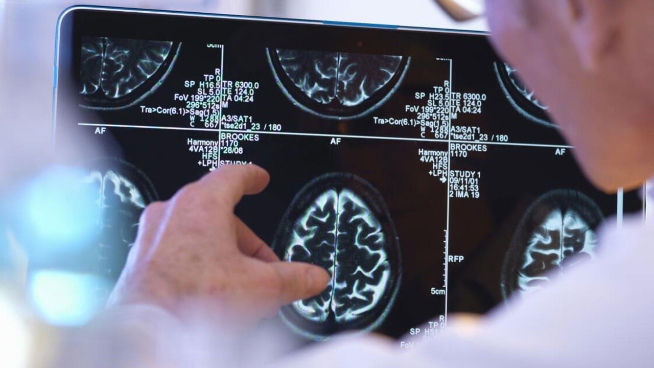 Çekmeyen bu ağrıyı bilemez! Migreni olan engelli mi sayılıyor?