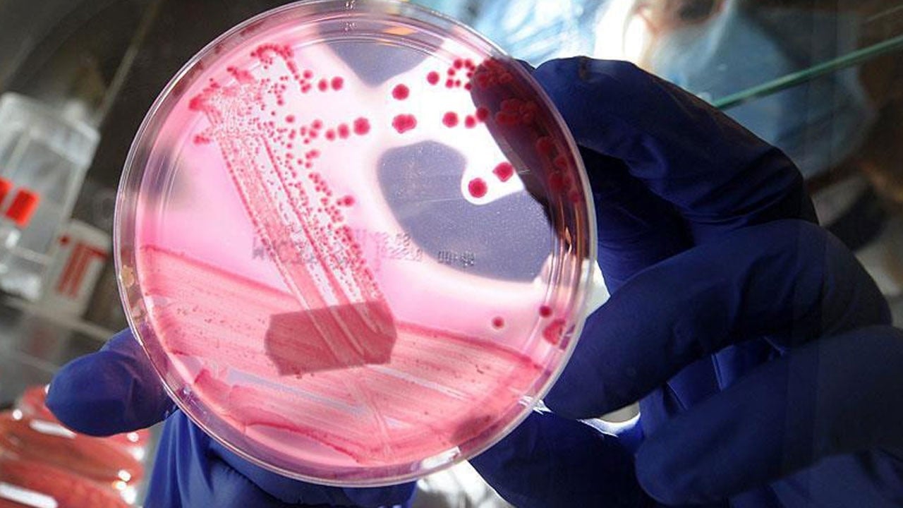 Çok geç belirti veriyor! Sessiz katil her geçen gün yayılıyor