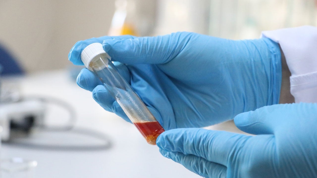 Çöpten sofraya yolculuk! Üzüm atığından tek hücre yağı