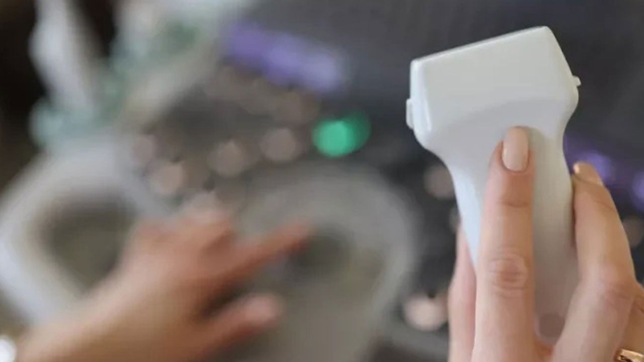 Damar hastalıklarında dev adım! Yeni Doppler teknolojisi erken tanıyı hızlandırıyor