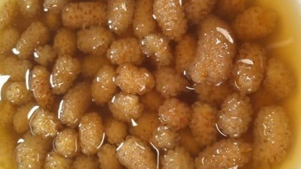 Doğal çözüm, kökten değişecek: Egzamadan kurtaran en iyi doğal tedavi! Kurtulmak isteyenler o yöntem bu